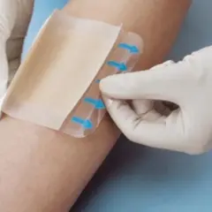 Ręce w rękawiczkach aplikują plaster hydrokoloidowy na skórę, pokazując jego elastyczność i sposób przylegania.
