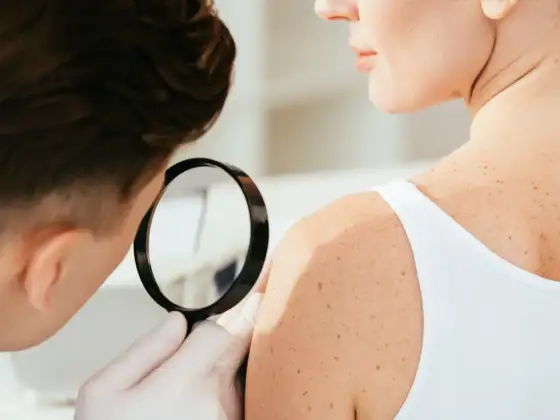 Dermatologia - czym zajmuje się dermatolog i kiedy iść do lekarza?